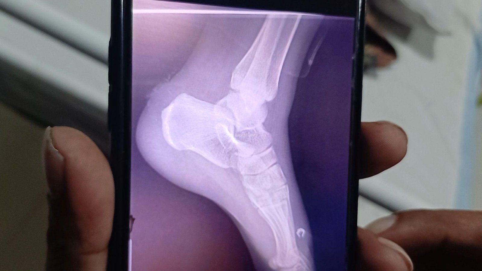 screenshot 20260129 221042 gallery3588777343436903889